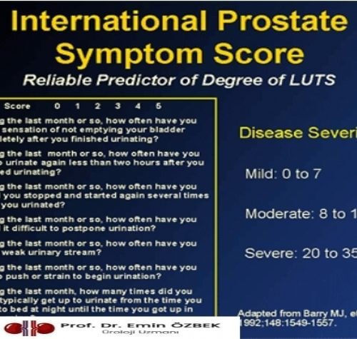İyi Huylu Prostat Büyümesi Olan Hastalarda (BPH) IPPS Testi Nedir?