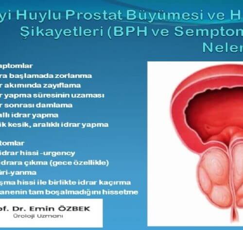 İyi Huylu Prostat Büyümesi ve Klinik Belirtileri