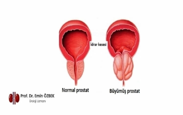 Prostat Nedir / Ne İşe Yarar / Prostat Anatomisi