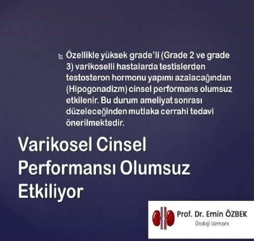 Varikosel Cinsel Performansı Yani Cinsel Gücü Olumsuz Etkiler mi?