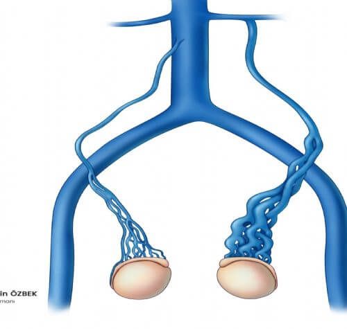 Varikosel Hastalığında Bitkisel Tedavi (Herbal Tedavi, Fitoterapi) ve Antioksidanlar Etkili mi?