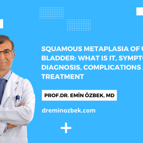 Squamous Metaplasia of Urinary Bladder: What is It, Symptoms. Diagnosis, Complications and Treatment