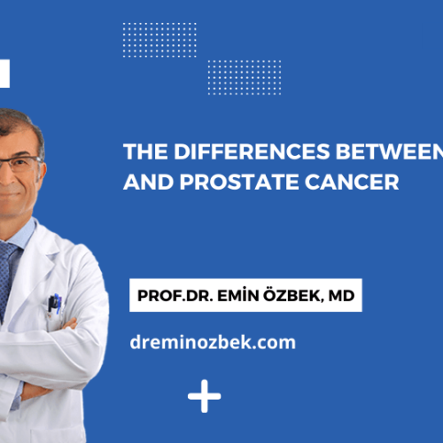 The Differences Between BPH and Prostate Cancer