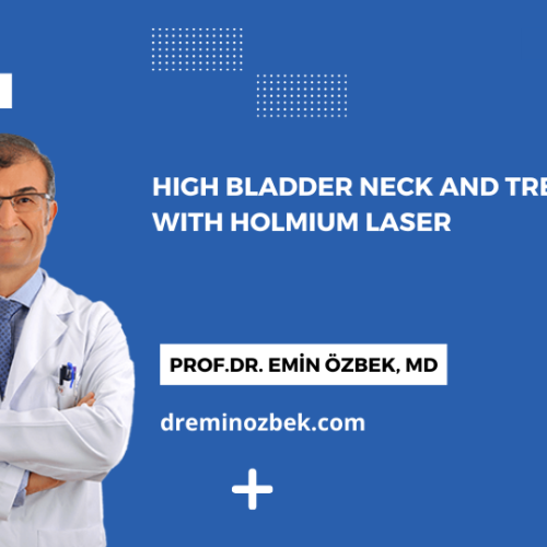 High Bladder Neck and Treatment with Holmium Laser