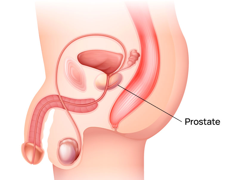 Prostat Sağlığı ve Prostat Muayenesi (Check Up)