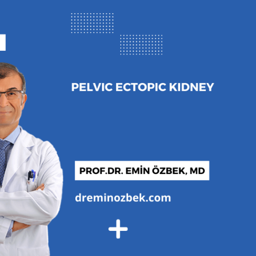 Pelvic Ectopic Kidney