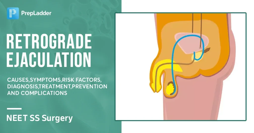 Retrograd Ejakülasyon Nedir, Nedenler ve Tedavi
