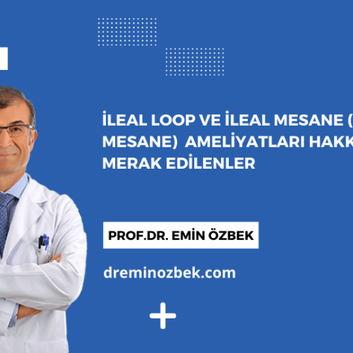 İleal Loop ve İleal Mesane (Yapay Mesane)  Ameliyatları Hakkında Merak Edilenler