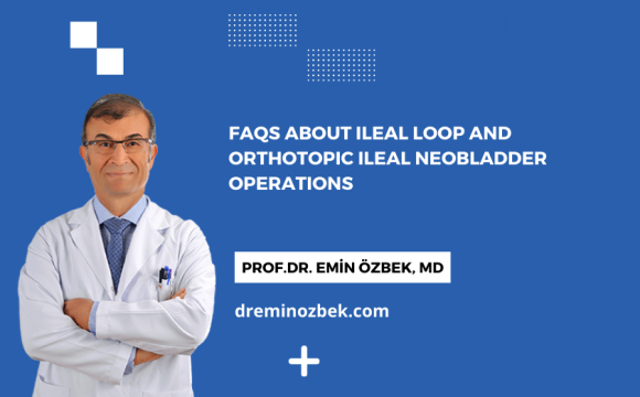 FAQs About Ileal Loop and Orthotopic Ileal Neobladder Operations