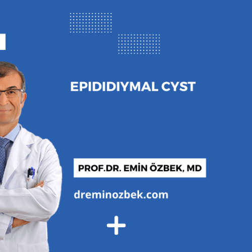 Epididiymal Cyst