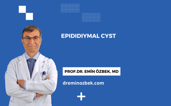 Epididiymal Cyst