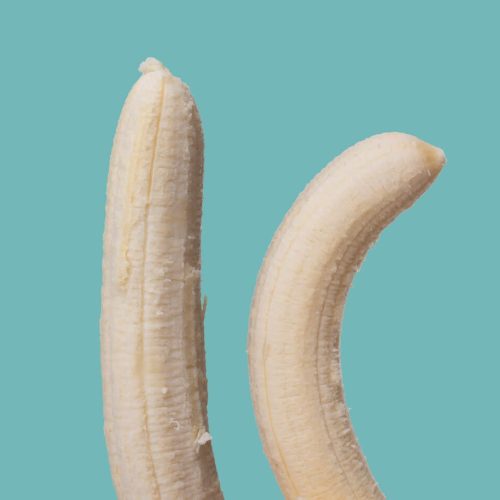 Courbure Congénitale du Pénis et Traitement